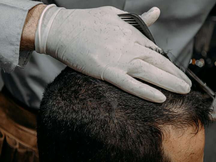 The Science of Restoration: Navigating Modern Hair Growth Solutions in 2026